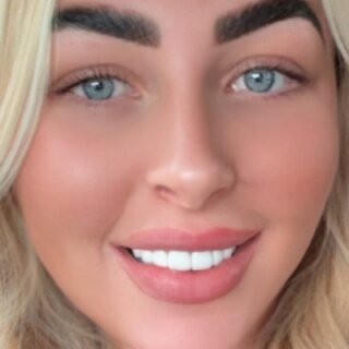 MissTease